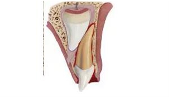 臨床實(shí)踐|乳牙外傷處理指引(值得兒牙醫(yī)生收藏) 臨床實(shí)踐|乳牙外傷處理指引(值得兒牙醫(yī)生收藏)