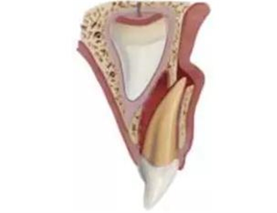 臨床實(shí)踐|乳牙外傷處理指引(值得兒牙醫(yī)生收藏) 臨床實(shí)踐|乳牙外傷處理指引(值得兒牙醫(yī)生收藏)