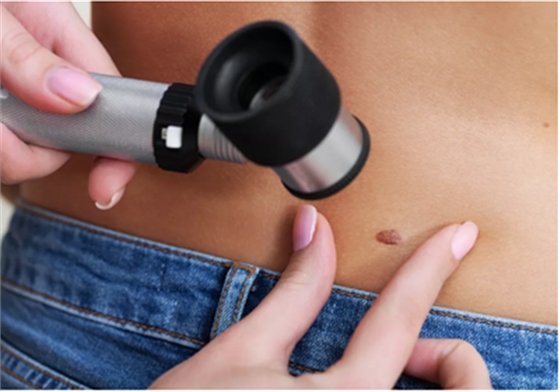 嘴巴里黑黑的好像長(zhǎng)了「痣」？你要當(dāng)心了