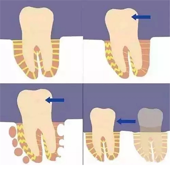 孩子必須換完牙才開(kāi)始整牙嗎？關(guān)于兒童正畸你應(yīng)該知道這些&hellip;&hellip;