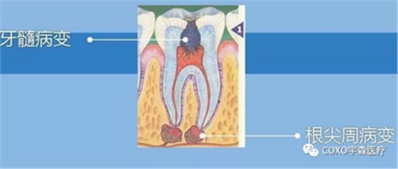 廠家來解說:多頻技術(shù)的根管長度測定儀 廠家來解說:多頻技術(shù)的根管長度測定儀