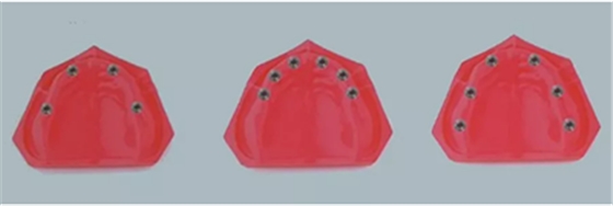 【熱點(diǎn)回顧】帶您深度了解無(wú)牙頜種植修復(fù)&mdash;&mdash;Pro Arch