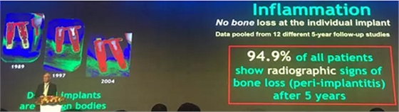 【聽(tīng)課筆記】種植體周?chē)俏找蛩匮芯颗c臨床意義