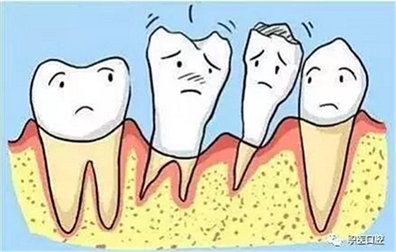 上海嘉?？谇谎芯克皇兰o牙周病的臨床進展