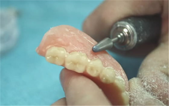 半路殺出粘接性修復(fù)體，真有那么神奇？