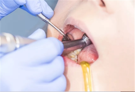 半路殺出粘接性修復(fù)體，真有那么神奇？