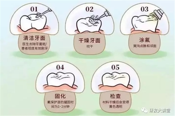 兒童防齲齒【窩溝封閉】和【涂氟】是一回事兒嗎？