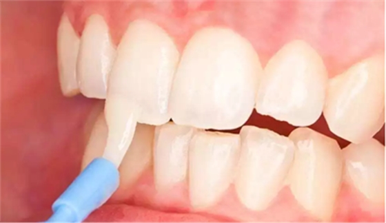 兒童齲病的預(yù)防 兒童齲病的預(yù)防