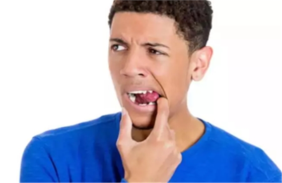 口腔預(yù)防 口腔預(yù)防