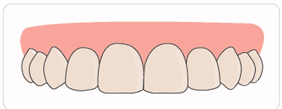 牙齦萎縮怎么辦？