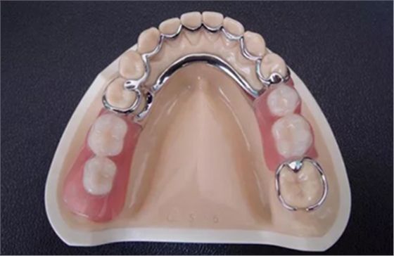 牙齦萎縮怎么辦？