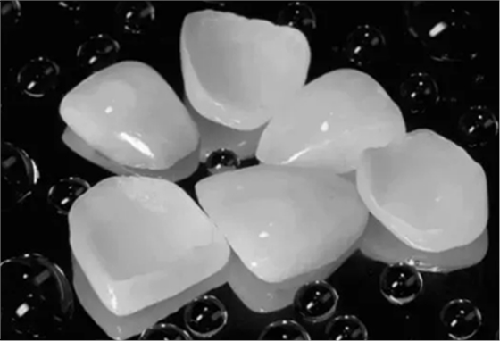 瓷貼面修復體最終顏色的影響因素 瓷貼面修復體最終顏色的影響因素