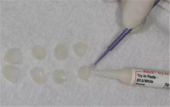 瓷貼面修復體最終顏色的影響因素 瓷貼面修復體最終顏色的影響因素