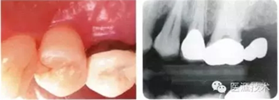 【牙周外科】牙齒的解剖形態(tài)(上篇) 【牙周外科】牙齒的解剖形態(tài)(上篇)