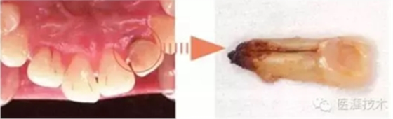 【牙周外科】牙齒的解剖形態(tài)(上篇) 【牙周外科】牙齒的解剖形態(tài)(上篇)