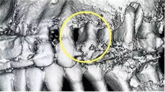 【牙周外科】牙齒的解剖形態(tài)(上篇) 【牙周外科】牙齒的解剖形態(tài)(上篇)