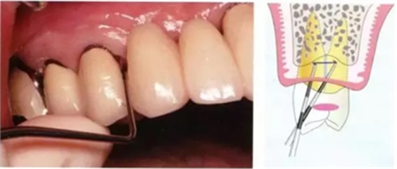 【牙周外科】牙齒的解剖形態(tài)(上篇) 【牙周外科】牙齒的解剖形態(tài)(上篇)