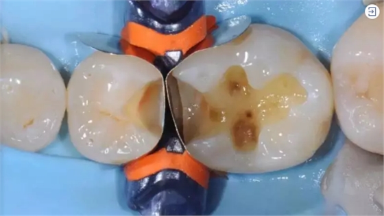 	 牙醫(yī)停診了？別怕，請您收下這份居家牙科急癥指南！