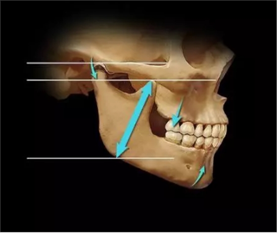 如何利用垂直距離解決好臨床問(wèn)題 如何利用垂直距離解決好臨床問(wèn)題