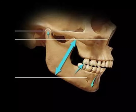 如何利用垂直距離解決好臨床問(wèn)題 如何利用垂直距離解決好臨床問(wèn)題