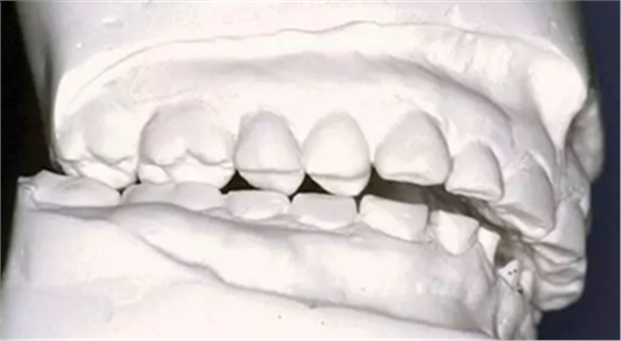 如何利用垂直距離解決好臨床問(wèn)題 如何利用垂直距離解決好臨床問(wèn)題