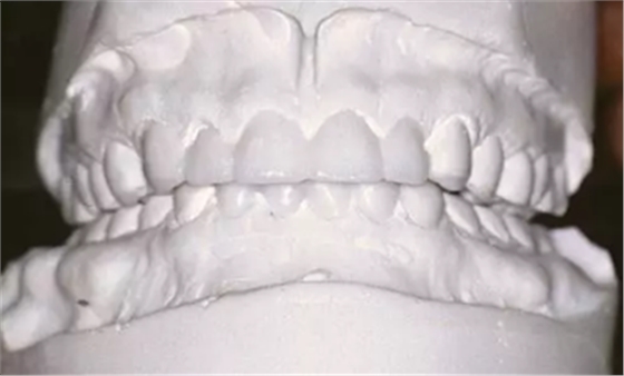 如何利用垂直距離解決好臨床問(wèn)題 如何利用垂直距離解決好臨床問(wèn)題