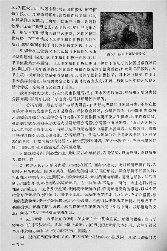 《實(shí)用拔牙學(xué)》一級(jí)教授陳華主編