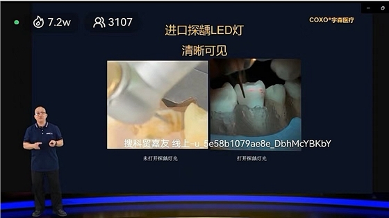 宇森新品發(fā)布探齲去腐手機(jī) 宇森新品發(fā)布探齲去腐手機(jī)