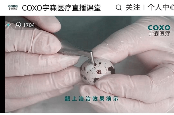 宇森口內(nèi)噴砂潔牙機CP-1新品發(fā)布 宇森口內(nèi)噴砂潔牙機CP-1新品發(fā)布