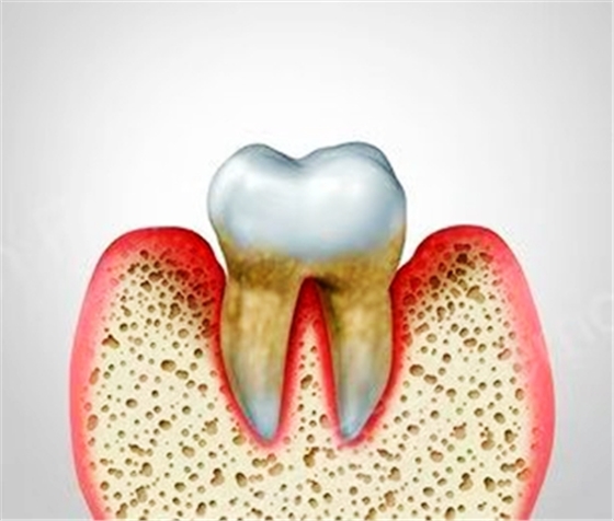 牙周病總是來勢洶洶？有辦法預(yù)防嗎？