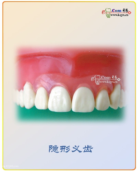 醫(yī)患溝通圖譜收集    推薦