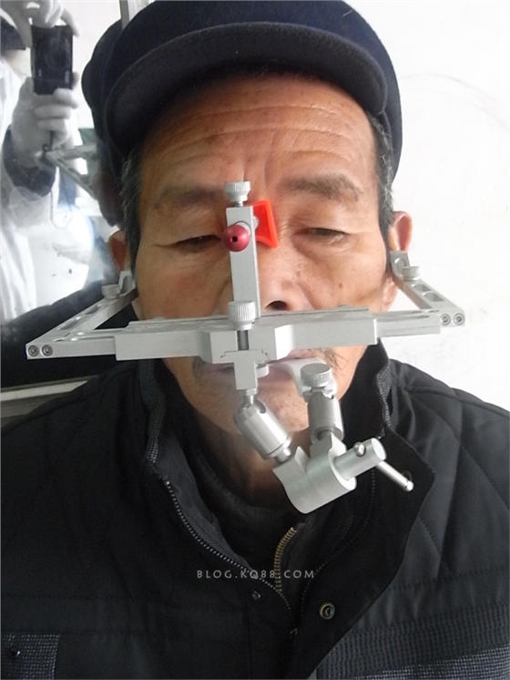 半可調(diào)頜架與面弓的使用 半可調(diào)頜架與面弓的使用