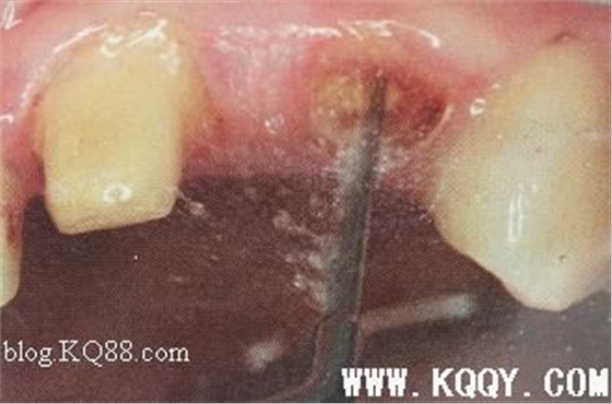 點擊瀏覽下一頁