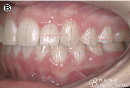 20150609205357_20593.png 20150609205357_20593.png