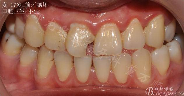 RPRMD%{7%4S6GM8X6E@)523.png RPRMD%{7%4S6GM8X6E@)523.png