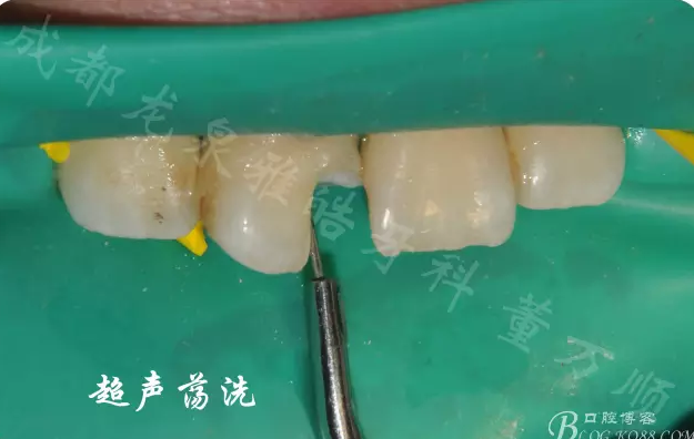 QQ圖片20150710101709.png QQ圖片20150710101709.png