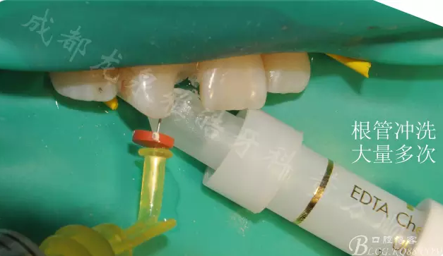 QQ圖片20150710101852.png QQ圖片20150710101852.png