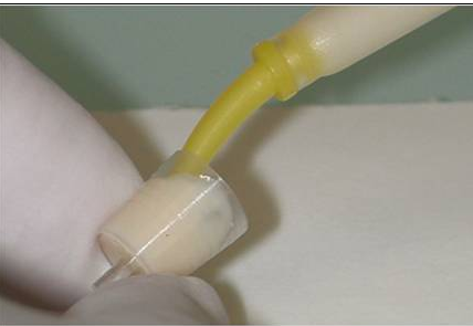 后牙烤瓷橋備牙全過程 后牙烤瓷橋備牙全過程