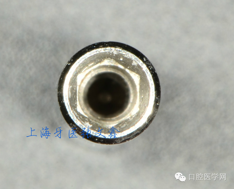 種植替代體上的細(xì)節(jié)不可忽視 種植替代體上的細(xì)節(jié)不可忽視