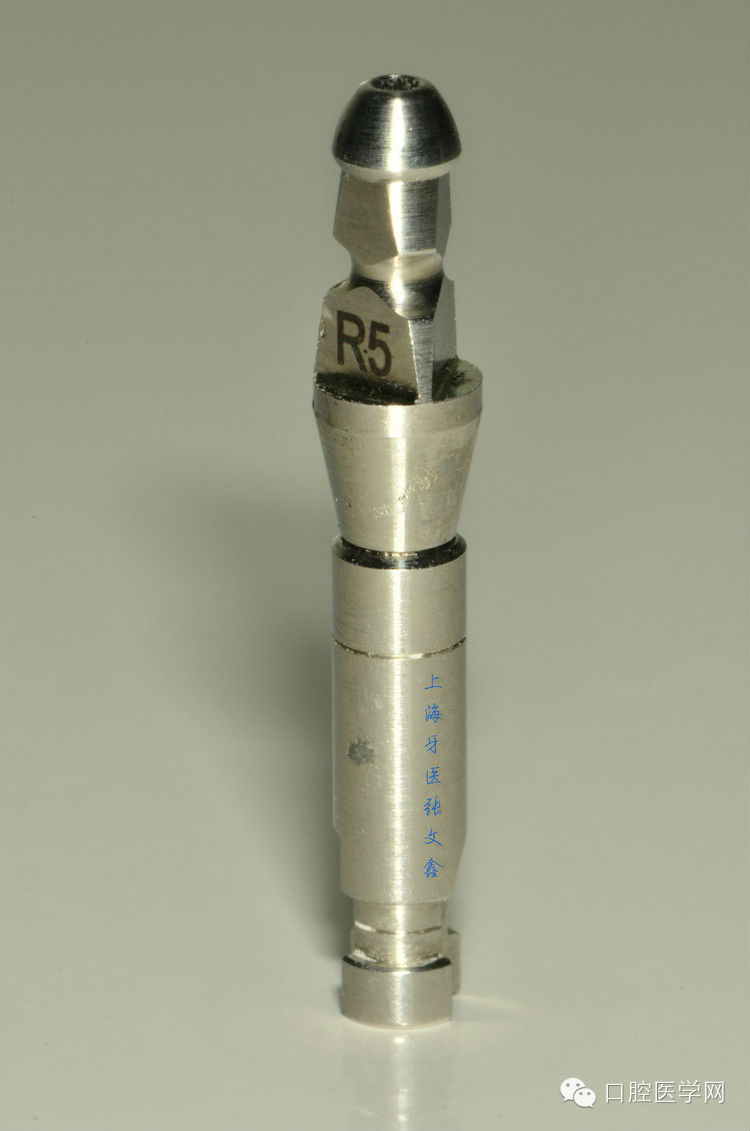 種植替代體上的細(xì)節(jié)不可忽視 種植替代體上的細(xì)節(jié)不可忽視