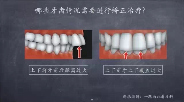 QQ圖片20150710143642.png QQ圖片20150710143642.png