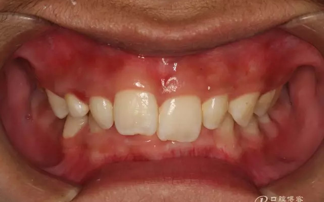 QQ圖片20150710153311.png QQ圖片20150710153311.png