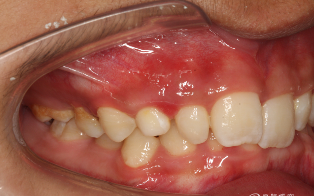 QQ圖片20150710153724.png QQ圖片20150710153724.png