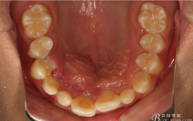 QQ圖片20150710153925.png QQ圖片20150710153925.png