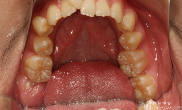 QQ圖片20150710154016.png QQ圖片20150710154016.png