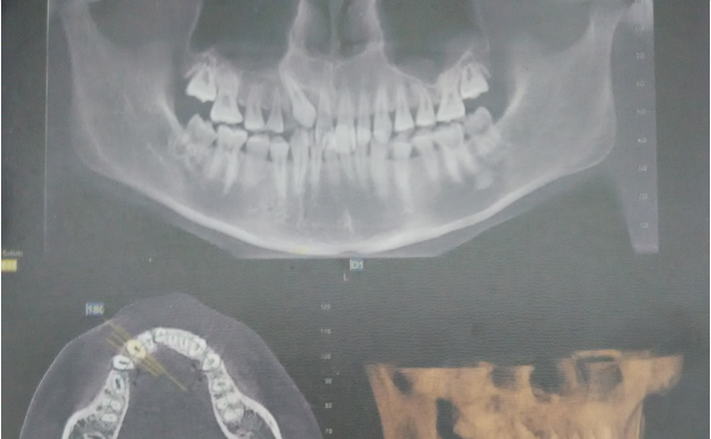 QQ圖片20150710154106.png QQ圖片20150710154106.png