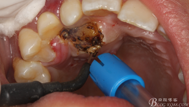 QQ圖片20150710154307.png QQ圖片20150710154307.png