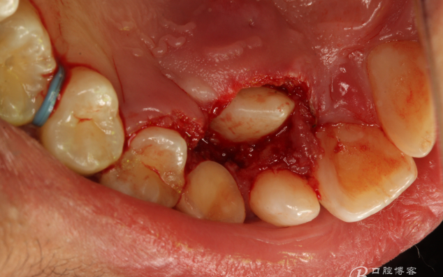 QQ圖片20150710154452.png QQ圖片20150710154452.png