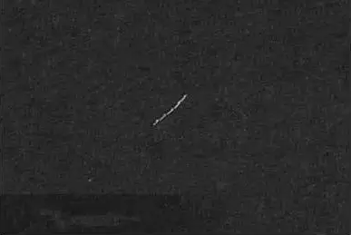 根管治療中斷針及處理方法 根管治療中斷針及處理方法