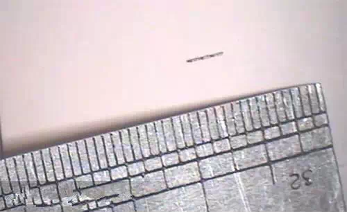 根管治療中斷針及處理方法 根管治療中斷針及處理方法